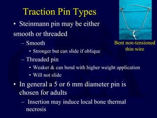 Example Of Dutchman Pin Thread Rework Closed_Reduction,_Traction_and_Casting_Techniques.pdf