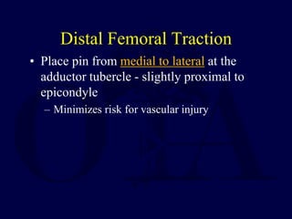 Distal Traction Rotation Closed_Reduction,_Traction_and_Casting_Techniques.pdf