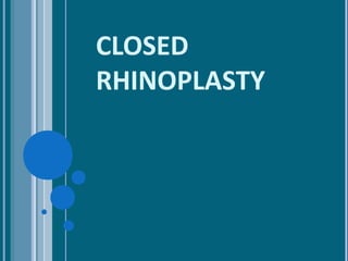 CLOSED
RHINOPLASTY
 