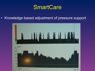 Knowledge based adjustment of pressure support SmartCare 