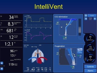 IntelliVent 