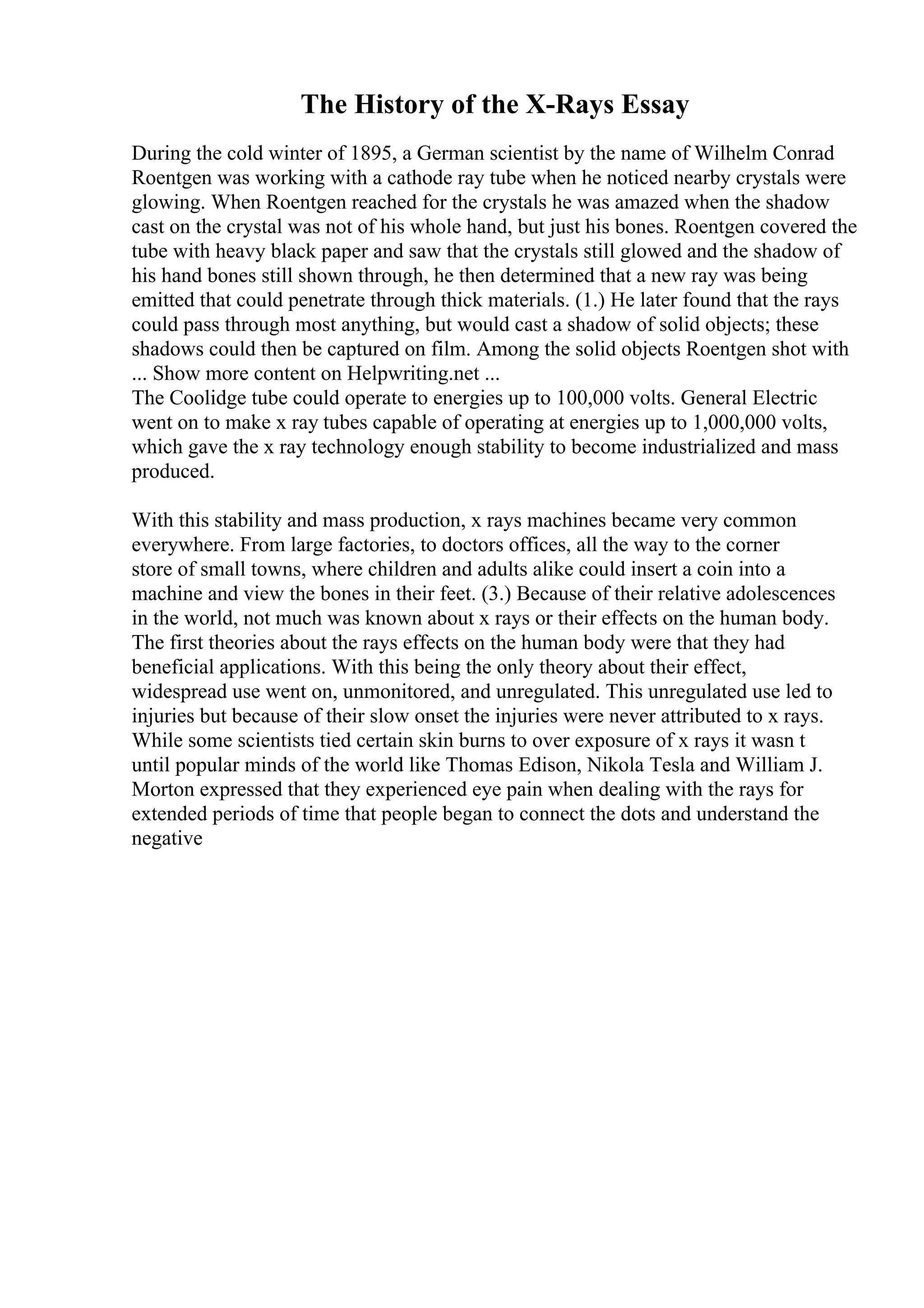 The History of the X-Rays Essay
During the cold winter of 1895, a German scientist by the name of Wilhelm Conrad
Roentgen was working with a cathode ray tube when he noticed nearby crystals were
glowing. When Roentgen reached for the crystals he was amazed when the shadow
cast on the crystal was not of his whole hand, but just his bones. Roentgen covered the
tube with heavy black paper and saw that the crystals still glowed and the shadow of
his hand bones still shown through, he then determined that a new ray was being
emitted that could penetrate through thick materials. (1.) He later found that the rays
could pass through most anything, but would cast a shadow of solid objects; these
shadows could then be captured on film. Among the solid objects Roentgen shot with
... Show more content on Helpwriting.net ...
The Coolidge tube could operate to energies up to 100,000 volts. General Electric
went on to make x ray tubes capable of operating at energies up to 1,000,000 volts,
which gave the x ray technology enough stability to become industrialized and mass
produced.
With this stability and mass production, x rays machines became very common
everywhere. From large factories, to doctors offices, all the way to the corner
store of small towns, where children and adults alike could insert a coin into a
machine and view the bones in their feet. (3.) Because of their relative adolescences
in the world, not much was known about x rays or their effects on the human body.
The first theories about the rays effects on the human body were that they had
beneficial applications. With this being the only theory about their effect,
widespread use went on, unmonitored, and unregulated. This unregulated use led to
injuries but because of their slow onset the injuries were never attributed to x rays.
While some scientists tied certain skin burns to over exposure of x rays it wasn t
until popular minds of the world like Thomas Edison, Nikola Tesla and William J.
Morton expressed that they experienced eye pain when dealing with the rays for
extended periods of time that people began to connect the dots and understand the
negative
 