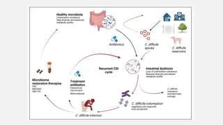 Comprehensive Overview of Clostridioides difficile Infection (CDI ...