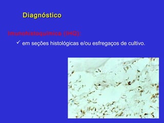 Diagnóstico

Imunohistoquímica (IHQ):
   em seções histológicas e/ou esfregaços de cultivo.
 