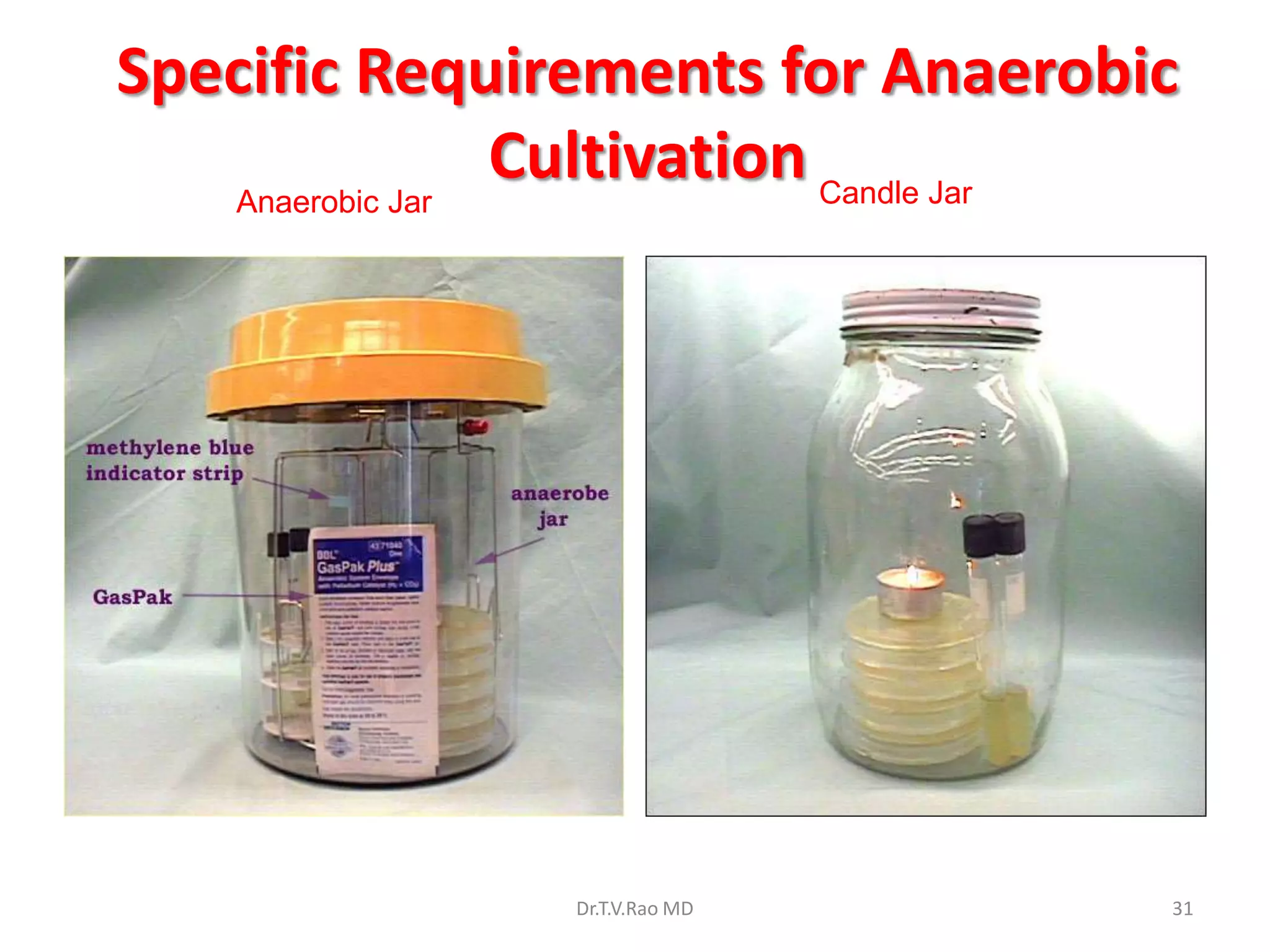 Specific Requirements for Anaerobic
   Anaerobic Jar
                 Cultivation Candle Jar




                Dr.T.V.Rao MD         31
 