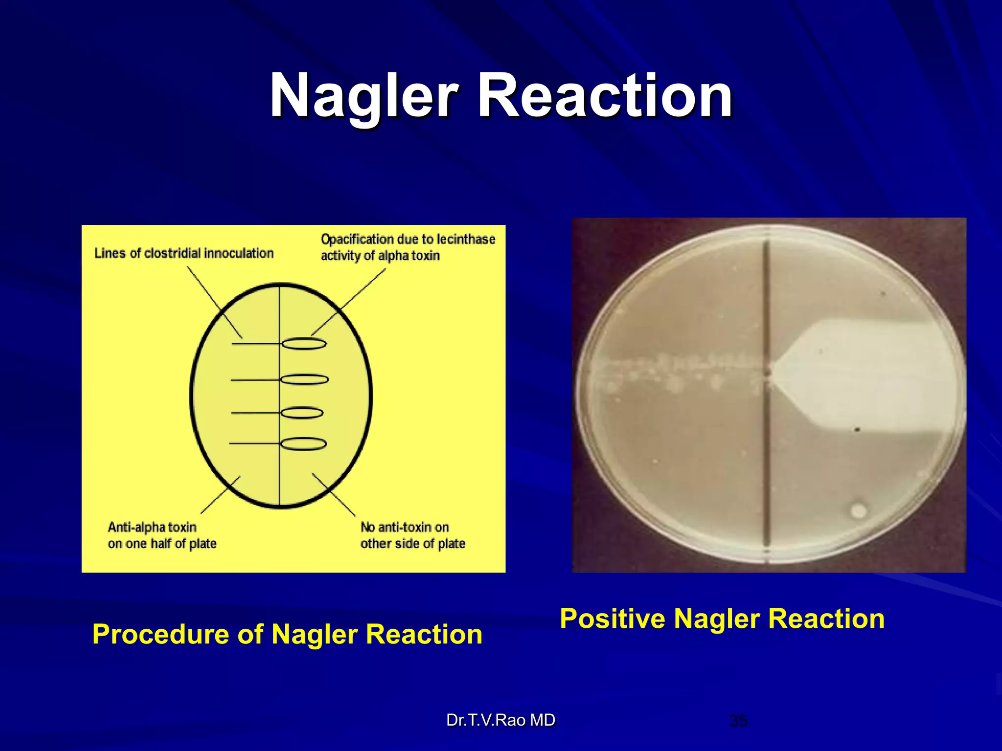Nagler Reaction




                                         Positive Nagler Reaction
Procedure of Nagler Reaction

                         Dr.T.V.Rao MD
 