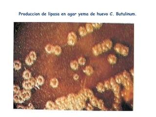 Produccion de lipasa en agar yema de huevo C. Butulinum.
 