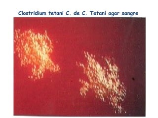 Clostridium tetani C. de C. Tetani agar sangre
 
