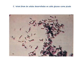 C. tetani.Gram de celulas desarrolladas en caldo glucosa-carne picada
 