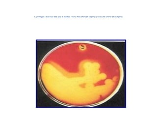 C. perfringens. Observese doble zona de hemólisis. Toxina theta inferior(H.completa) y toxina alfa exterior (H.incompleta)
 