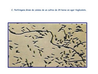 C. Perfringens.Gram de celulas de un cultivo de 24 horas en agar tioglicolato.
 