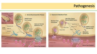 Pathogenesis
 