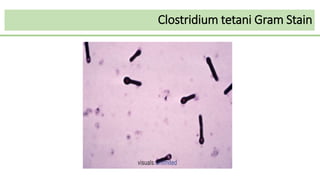 Clostridium tetani Gram Stain
 