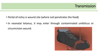 Transmission
• Portal of entry is wound site (where nail penetrates the food)
• In neonatal tetanus, it may enter through contaminated umbilicus or
circumcision wound.
 