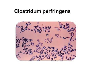 Clostridum perfringens
 