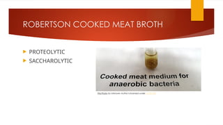 ROBERTSON COOKED MEAT BROTH
 PROTEOLYTIC
 SACCHAROLYTIC
This Photo by Unknown Author is licensed under CC BY-NC
 