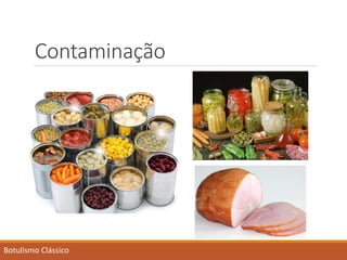 Contaminação 
Botulismo Clássico  