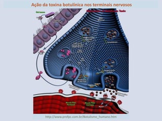 http://www.profpc.com.br/Botulismo_humano.htm 
Ação da toxina botulínica nos terminais nervosos  