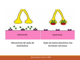 (Roque Oliveira Villarreal, 2008) 
Ação da toxina botulínica nos terminais nervosos 
Mecanismo de ação da Acetilcolina  