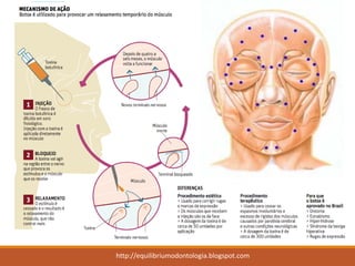 Para saber mais... 
http://equilibriumodontologia.blogspot.com  