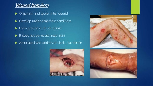 botulism in dogs clostridium botulinum disease botulism in dogs clostridium botulinum disease