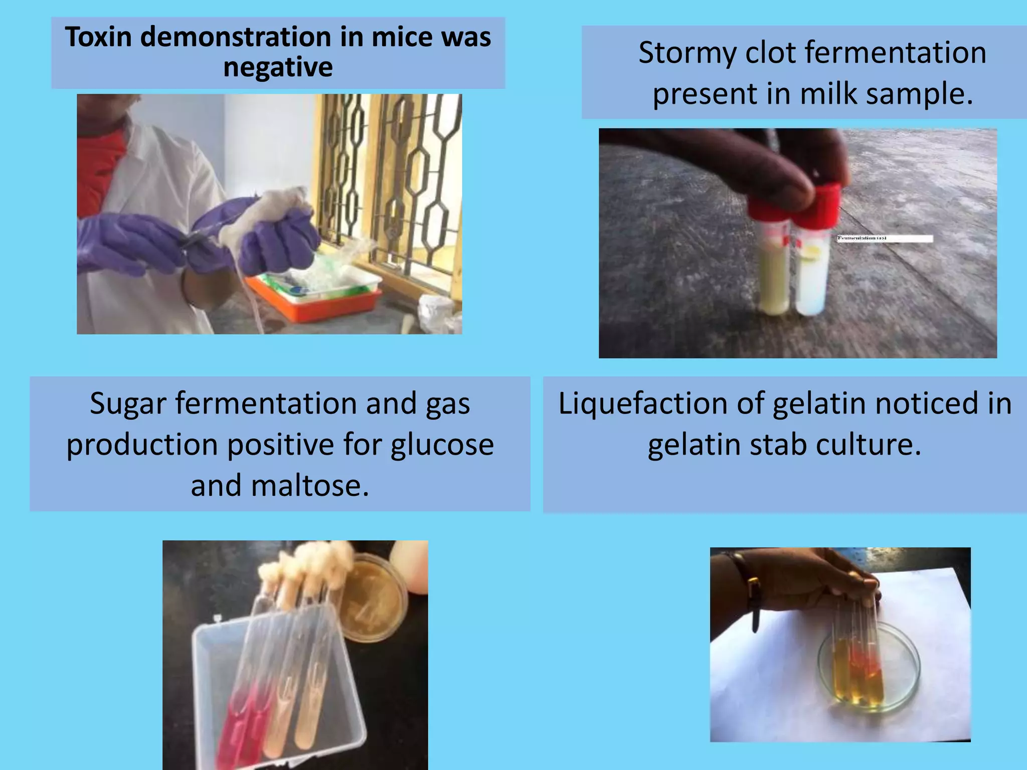 Clostridium botulinum ppt | PPTX