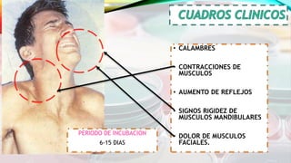 • CALAMBRES
• CONTRACCIONES DE
MUSCULOS
• AUMENTO DE REFLEJOS
• SIGNOS RIGIDEZ DE
MUSCULOS MANDIBULARES
• DOLOR DE MUSCULOS
FACIALES.
PERIODO DE INCUBACION
6-15 DIAS
 