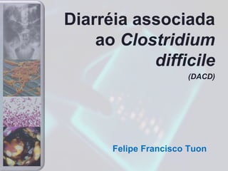 Felipe Francisco Tuon
Diarréia associada
ao Clostridium
difficile
(DACD)
 