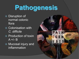 Pathogenesis 
 Disruption of 
normal colonic 
flora 
 Colonisation with 
C. difficile 
 Production of toxin 
A +/- B 
 Mucosal injury and 
inflammation 
 