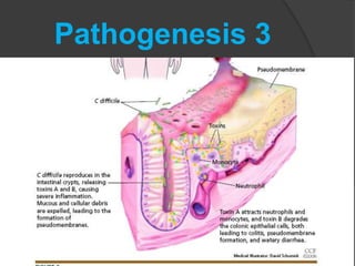 Pathogenesis 3 
 
