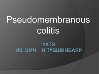 Pseudomembranous
colitis
 