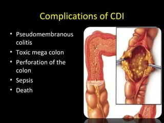 Clostridium diifficile | PPT