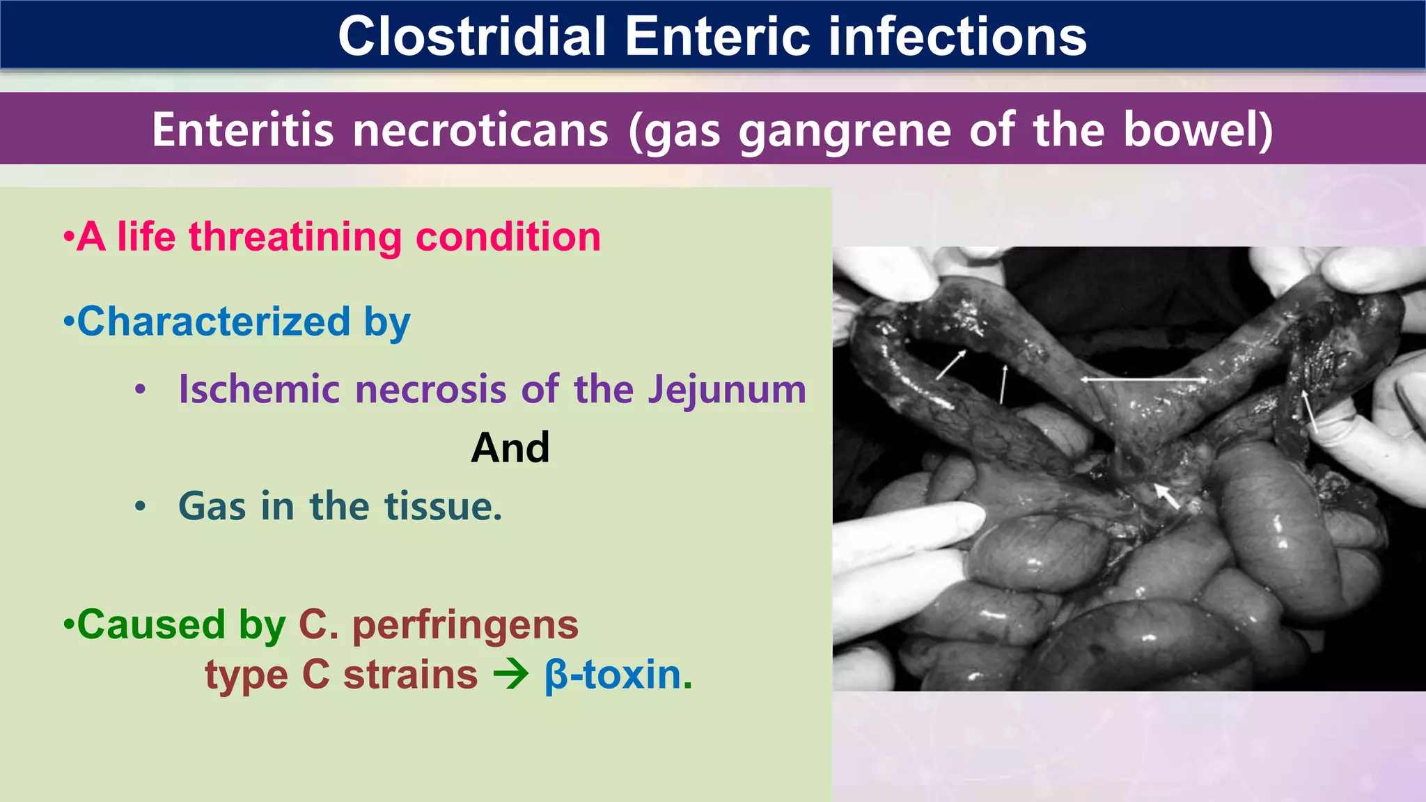 Clostridium perfringens.pptx