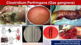 By Dr. Rakesh Prasad Sah
Associate Professor, Microbiology
Clostridium Perfringens (Gas gangrene)
 