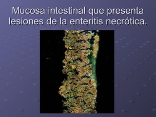 Mucosa intestinal que presenta lesiones de la enteritis necrótica. 