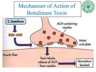 Mechanism of Action of
Botulinum Toxin
 