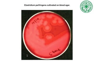 Clostridium perfringens cultivated on blood agar.
 