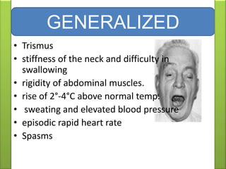 • Trismus
• stiffness of the neck and difficulty in
swallowing
• rigidity of abdominal muscles.
• rise of 2°-4°C above normal temp.
• sweating and elevated blood pressure
• episodic rapid heart rate
• Spasms
GENERALIZED
 