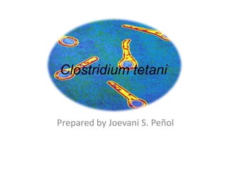 Clostridium tetani
Prepared by Joevani S. Peñol
 