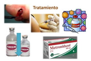 Tratamiento
 