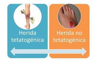 Herida
tetatogénica
Herida no
tetatogénica
 