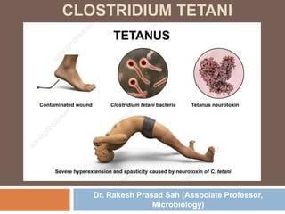 CLOSTRIDIUM TETANI
Dr. Rakesh Prasad Sah (Associate Professor,
Microbiology)
 
