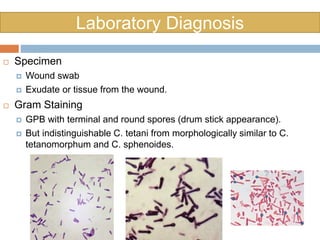 Laboratory Diagnosis
 Specimen
 Wound swab
 Exudate or tissue from the wound.
 Gram Staining
 GPB with terminal and round spores (drum stick appearance).
 But indistinguishable C. tetani from morphologically similar to C.
tetanomorphum and C. sphenoides.
 