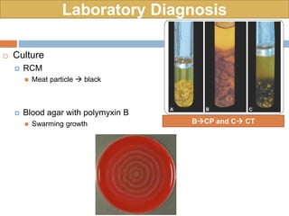 Laboratory Diagnosis
 Culture
 RCM
 Meat particle  black
 Blood agar with polymyxin B
 Swarming growth BCP and C CT
 