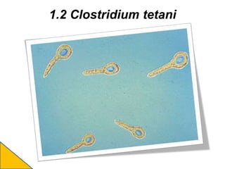 1.2 Clostridium tetani
 