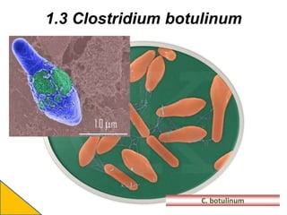 1.3 Clostridium botulinum
C. botulinum
 