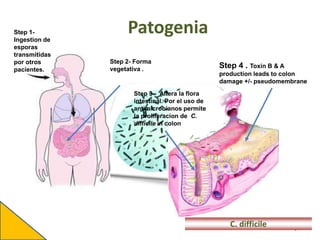 37
PatogeniaStep 1-
Ingestion de
esporas
transmitidas
por otros
pacientes.
Step 2- Forma
vegetativa .
Step 3 - Altera la flora
intestinal. Por el uso de
antimicrobianos permite
la proliferacion de C.
difficile in colon
Step 4 . Toxin B & A
production leads to colon
damage +/- pseudomembrane
C. difficile
 