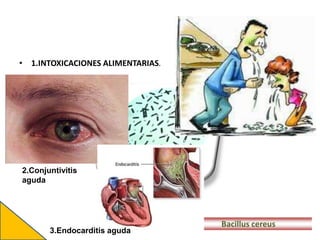 • 1.INTOXICACIONES ALIMENTARIAS.
Bacillus cereus
2.Conjuntivitis
aguda
3.Endocarditis aguda
 