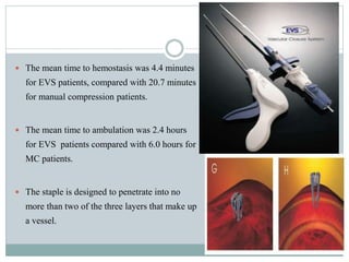 Closure devices | PPTX