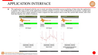 19
APPLICATION INTERFACE
 The application was designed with the user in mind, providing immediate access to plotting of data when the application
is opened. The main screen of the application contains a button to access a list of Bluetooth access points, a graph upon
which to plot an ECG signal, buttons to send a request for data analysis and to clear the current data stream, and a text
field that displays the results of analysis.
 